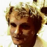 endoproteza-kolena - slika 2